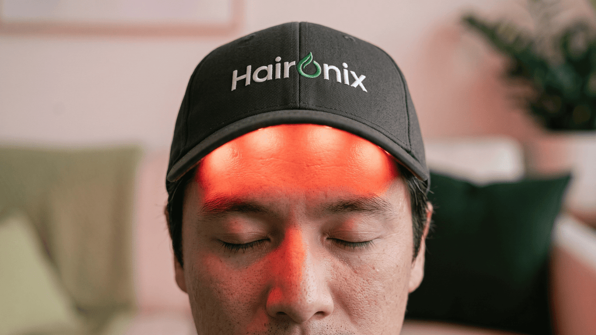 Red light therapy frontal hairline treatment using a wearable cap device