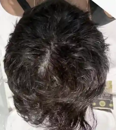 After